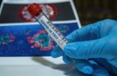 Dvije novooboljele osobe na otoku Krku, peti dan za redom nema preminulih od koronavirusa u PGŽ-u