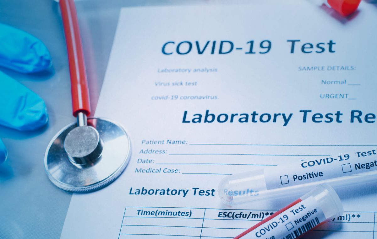 9 novozaraženih na Krku, u županiji 75 novih slučajeva koronavirusa
