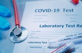 6 novozaraženih danas na Krku, u PGŽ-u ukupno 391 novi slučaj koronavirusa