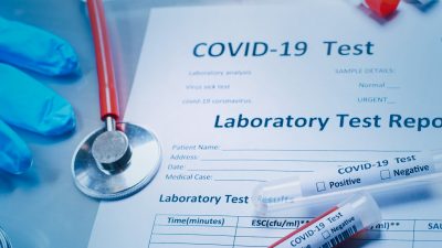 Na Krku 22, u županiji 171 novi slučaj koronavirusa