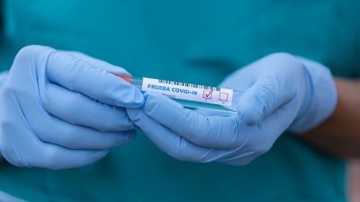 5 novozaraženih na Krku, u PGŽ-u 498 novih slučajeva koronavirusa