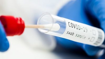 1 novozaraženi na Krku, u PGŽ-u nastavlja padati ukupni broj aktivnih slučajeva COVID-a