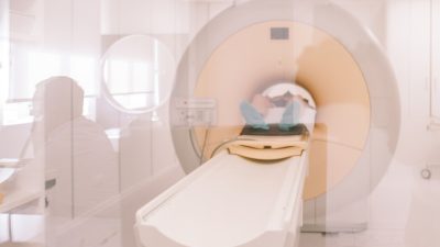 Treba vam magnetska rezonanca? Saznali smo gdje su termini za MR dostupni tijekom cijelog ljeta bez čekanja – čak i subotom